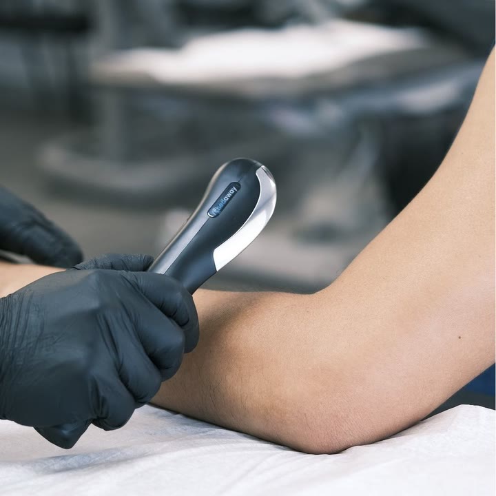 Therapist scraping a client's forearm with the Mini Scraper